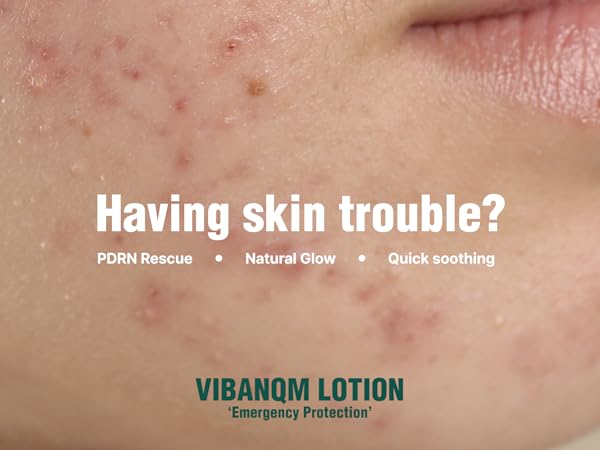 Amazon.com: VQM VIBANQUENTMANKA Lotion – Korean Moisturizer for