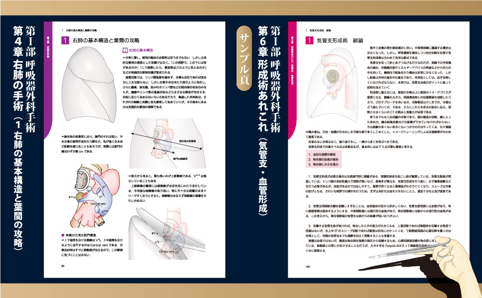 イラストで理解する呼吸器外科手術のエッセンス | 伊藤 宏之 |本