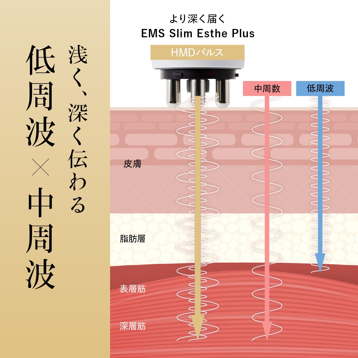 EMS Slim Esthe Plus | 健康 | WAVEWAVE