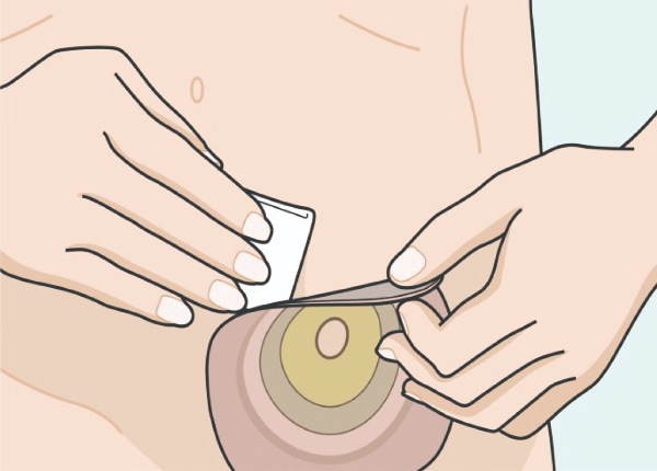 アダプト剥離剤パック｜ヤガミホームヘルスセンター e.よりそうだん