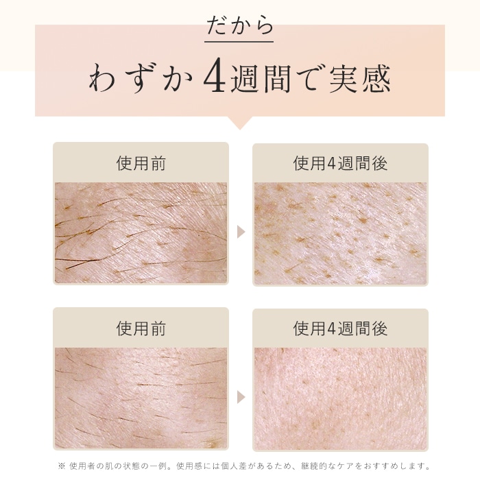 STELLA BEAUTE（ステラ）IPL光美容器Lunaルナ – SOISHOP