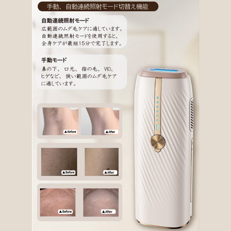 脱毛器 ハイパワー連射 ルピエ（LUPIE）高級サファイアガラスヘッド