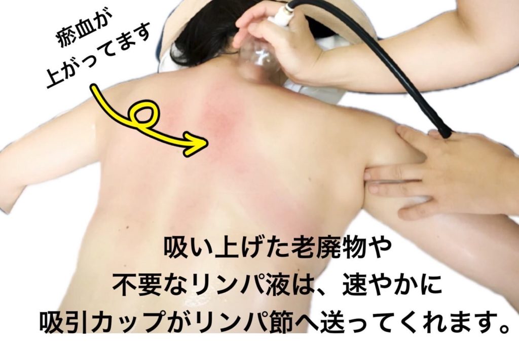 1DAYボディスクールのご紹介です。かっさスクール・吸い玉スクール