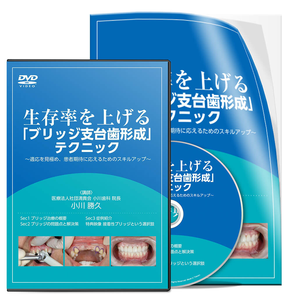 生存率を上げる「ブリッジ支台歯形成」テクニック ～適応を見極め