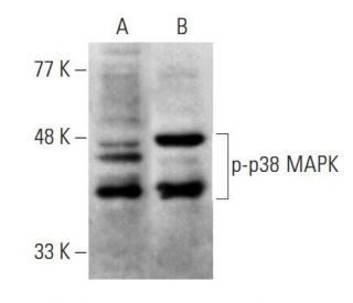 p-p38 MAPK抗体(E-1) | SCBT - Santa Cruz Biotechnology