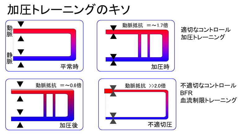 医師解説：【血流の】“ニセ”加圧トレーニングにご用心【適切な