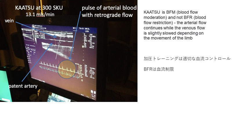 医師解説：【血流の】“ニセ”加圧トレーニングにご用心【適切な