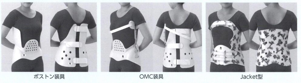 側弯症(思春期特発性側弯症) の症状、原因、治療 | 桃谷うすい整形外科