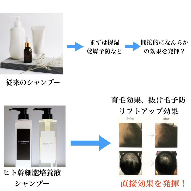 月間50本限定！ヒト幹細胞培養液 イリュージョニストシャンプーの効果
