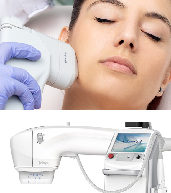 HIFU (ウルトラセルQ+) | La Clinique（大阪・名古屋の美容外科）