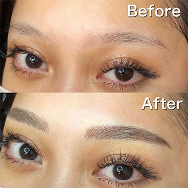 症例紹介 | 名古屋でアートメイクならオニキスアートメイクラボ