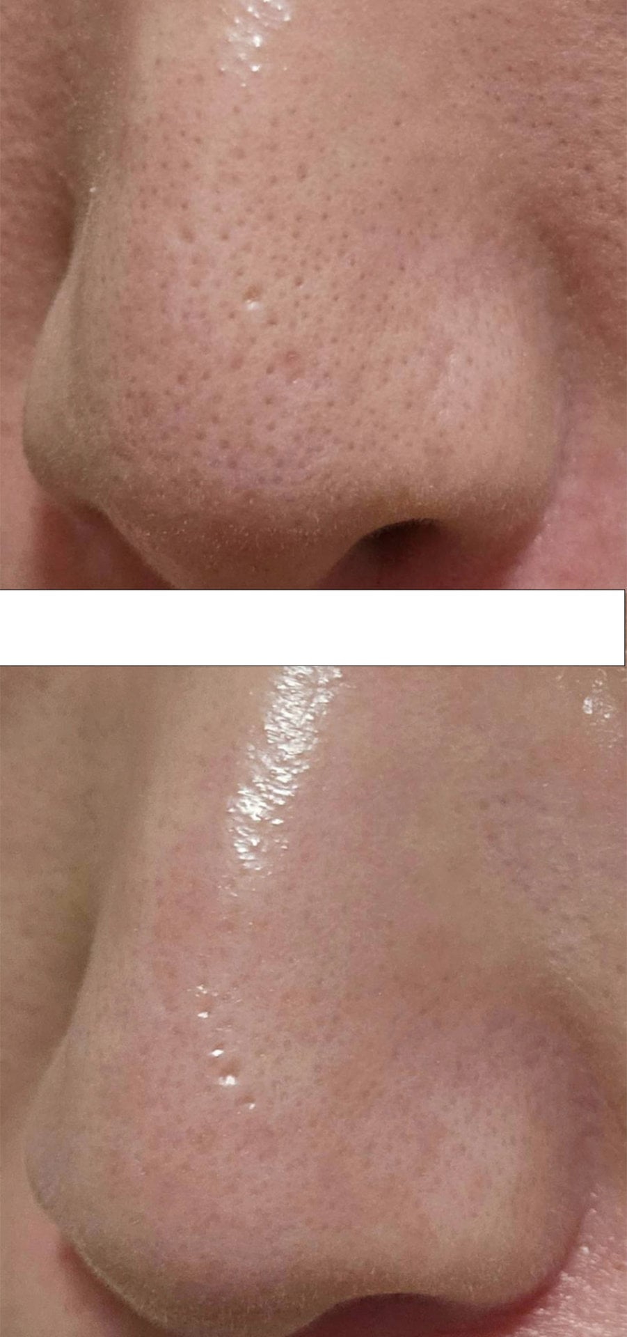 一発で勝負が決まる!? 毛穴ケアのスキンケア【SMORE】のクレンジング