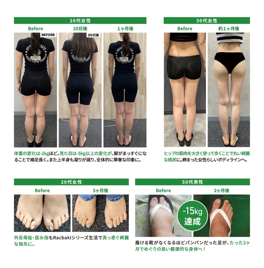 オーバープロネーション改善をサポート！歩くだけで体型を整える新感覚