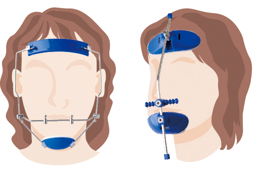 プレミアムプラスジャパン｜Premium Plus Japan｜フェイスマスク-矯正