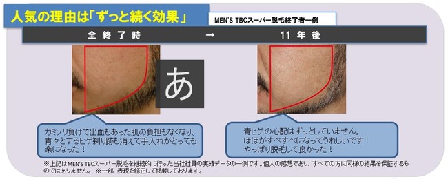 ヒゲ脱毛 利用者数 年々増加！ | TBCグループ株式会社のプレスリリース