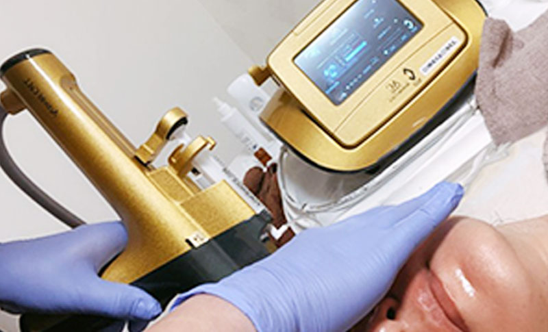 ヒト幹細胞エアジェットでの施術のご紹介ページです