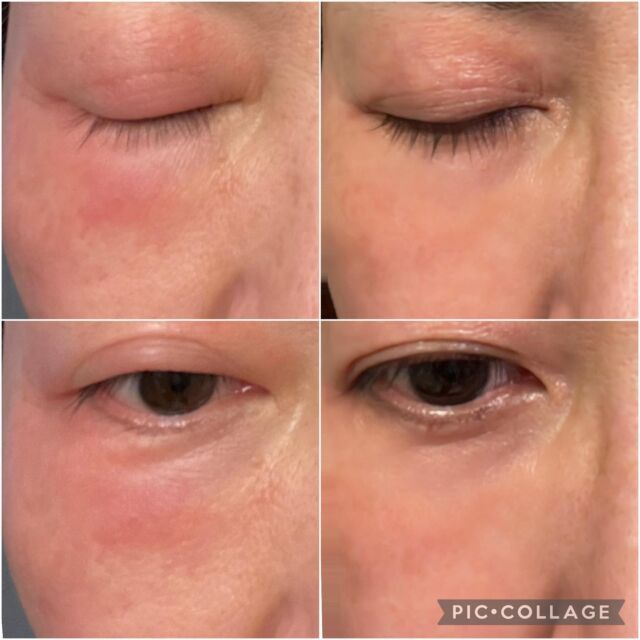 シャルムボー ピールオフ CO2パック シャルム・ボー化粧品 | シャルム