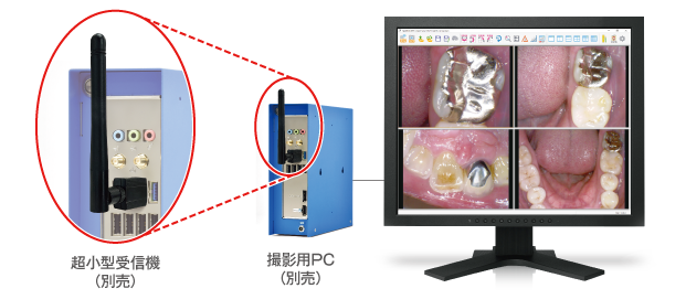 Wi-Fiワイヤレス口腔内カメラ｜アールエフ