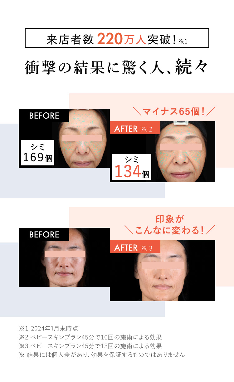 ボディアーキ ベビースキン プラン」誕生 | 【公式】定額制セルフ