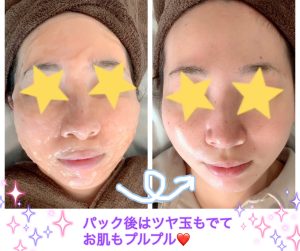 ➂シャルムボー炭酸CO2 パック剥がせる。ピールオフ20ピース ➂