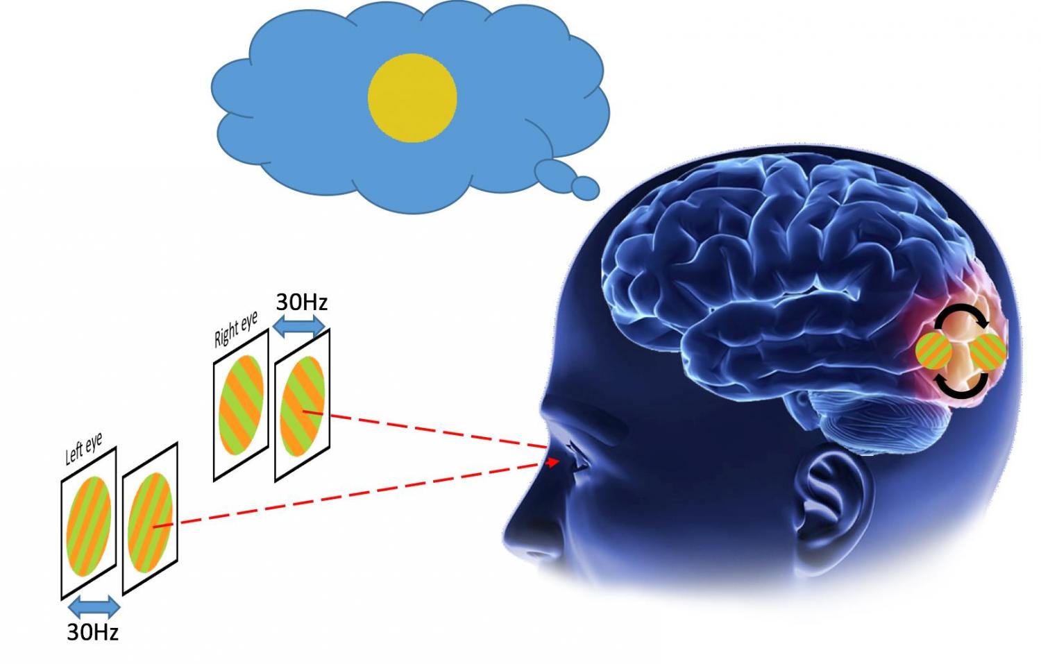 Human early visual cortex subconsciously resolves invisible conflicts