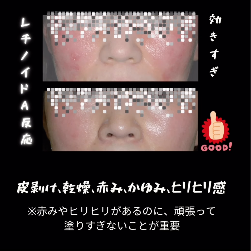 ゼオスキンヘルス デイリーPD 50ml – sakuraclinic-online