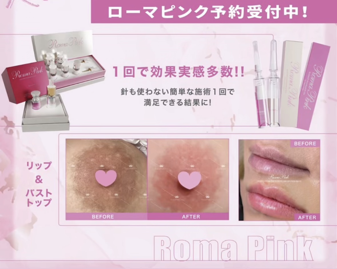 ローマピンク | 大分県中津市のホワイトニング・脱毛サロン Diar(ディアー)