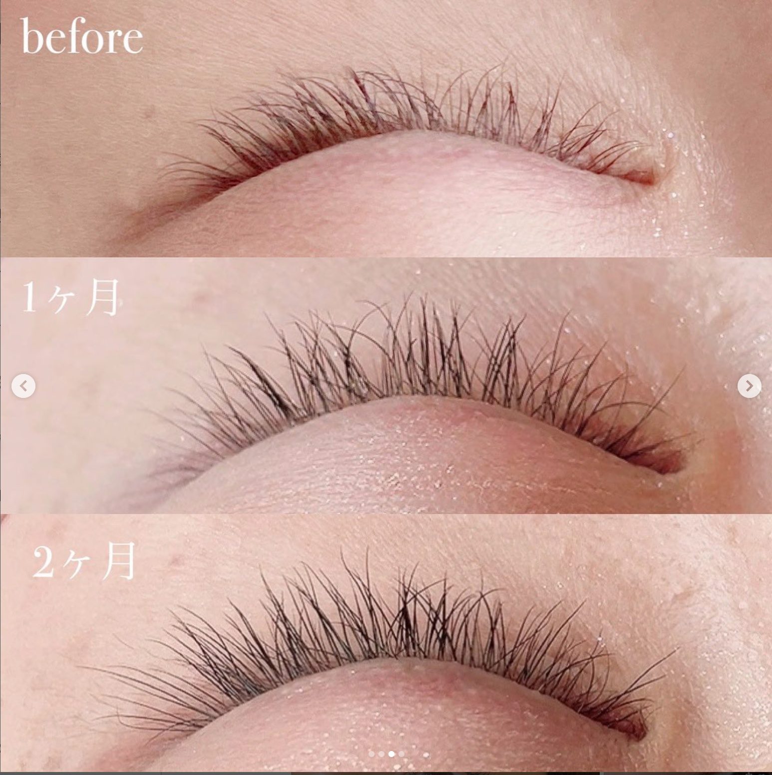 仕入れ/卸】まつげ美容液のラッシュアディクトとエグータムはどっちが