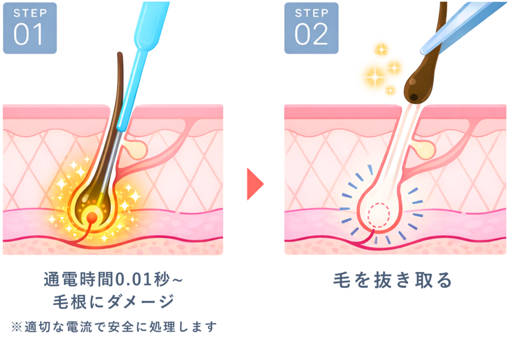 初回体験30分¥10,000 男女OK】柏駅徒歩7分｜硬毛化｜白髪｜眉まわり