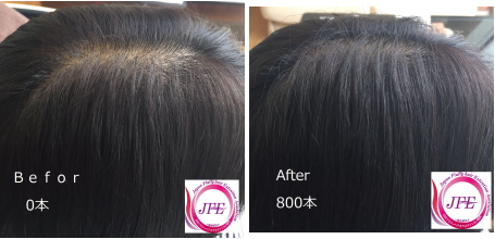 増毛エクステ|増毛|薄毛|ポイントカラー|髪|毛|ボリュームアップ