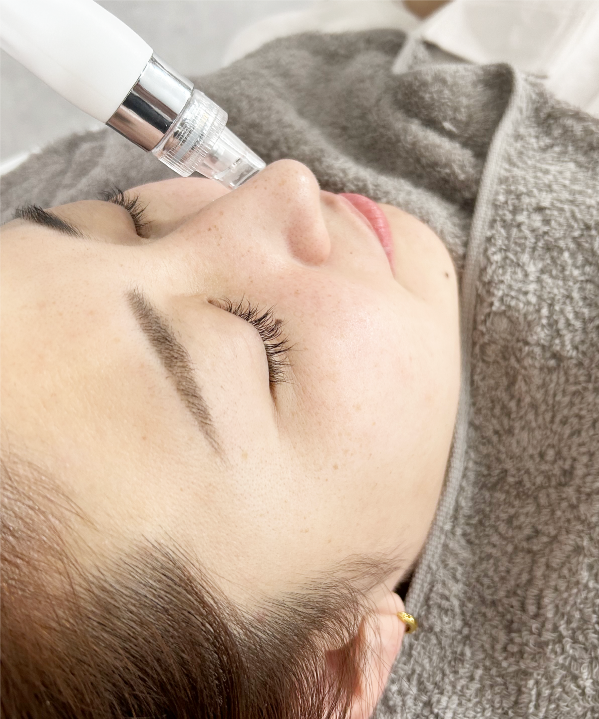 毛穴洗浄・ハイドラ｜神戸元町・三宮のエステサロン「SALON VIM