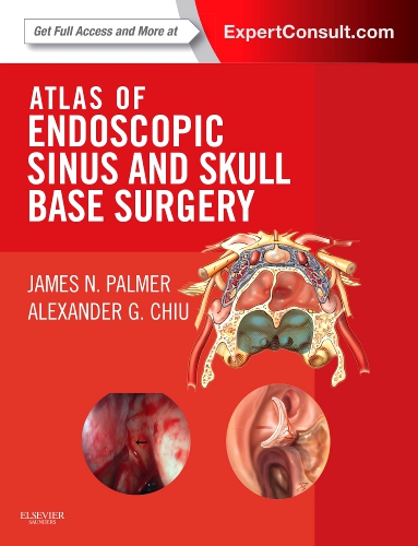 Atlas of Endoscopic Sinus and Skull Base Surgery - 1st Edition