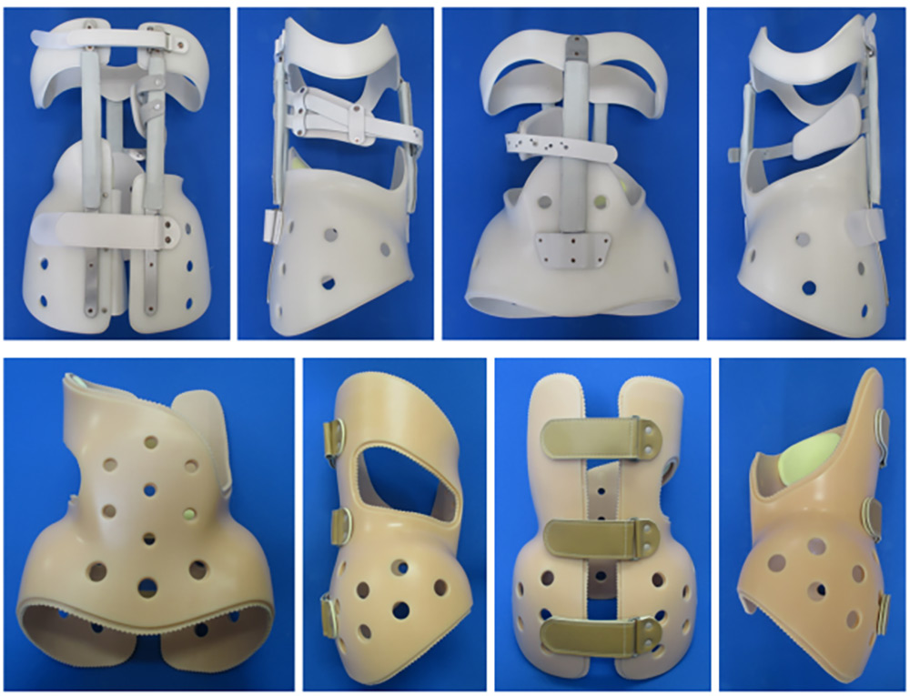 脊柱側弯症（特発性側弯症 症候性側弯症） ｜ 総合せき損センター