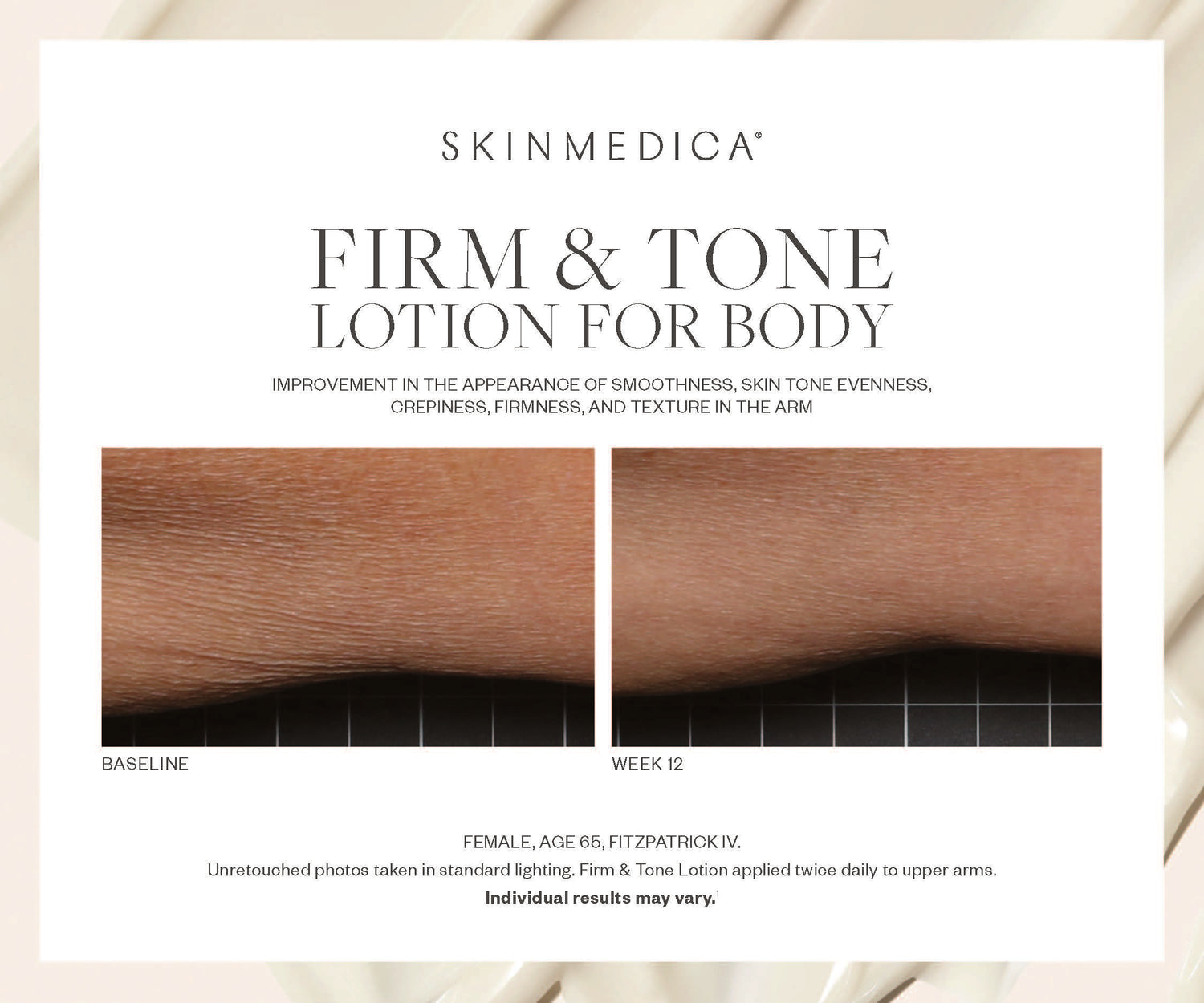 SkinMedica SkinMedica Firm & Tone Lotion for Body – skinfo