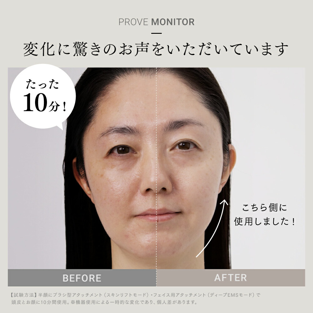 公式｜期間限定 5%OFFクーポン+P5倍！】EMS 美顔器 リフトアップ