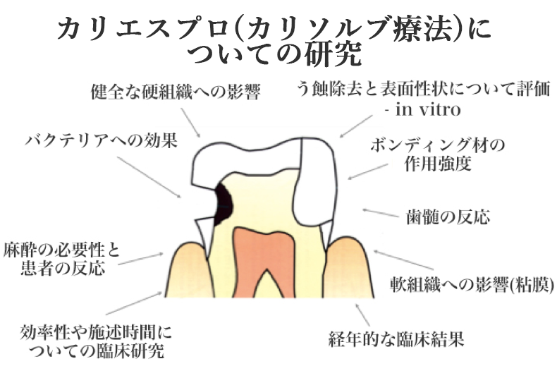 削らず痛まないカリソルブ／ぺリソルブ虫歯・歯周病治療｜カリエスプロ