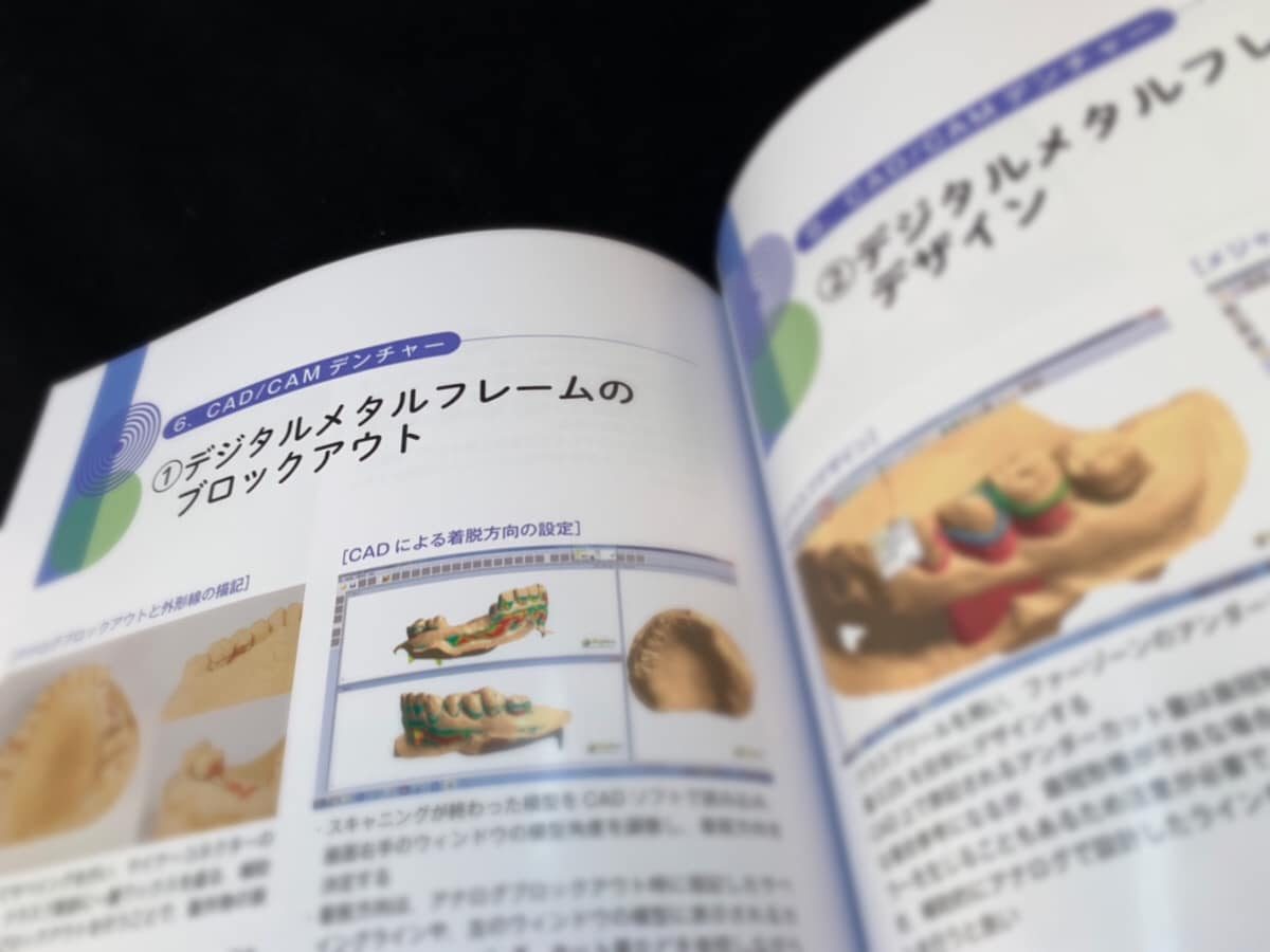 執筆情報》歯科技工別冊にて「デジタル技工入 61のポイント」が上梓