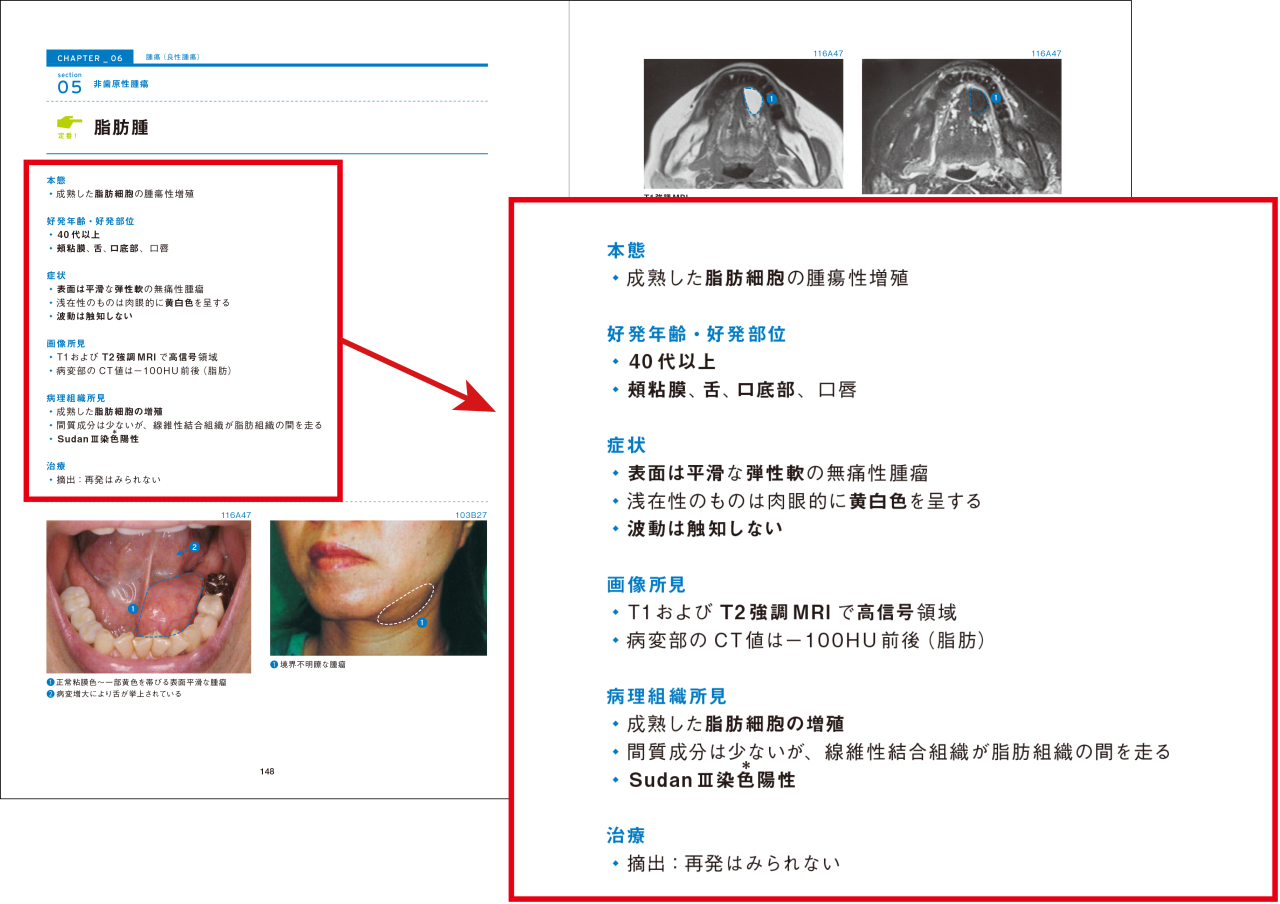 多くの受験生に選ばれたロングセラー書籍が改訂！ 「口腔外科セレクト