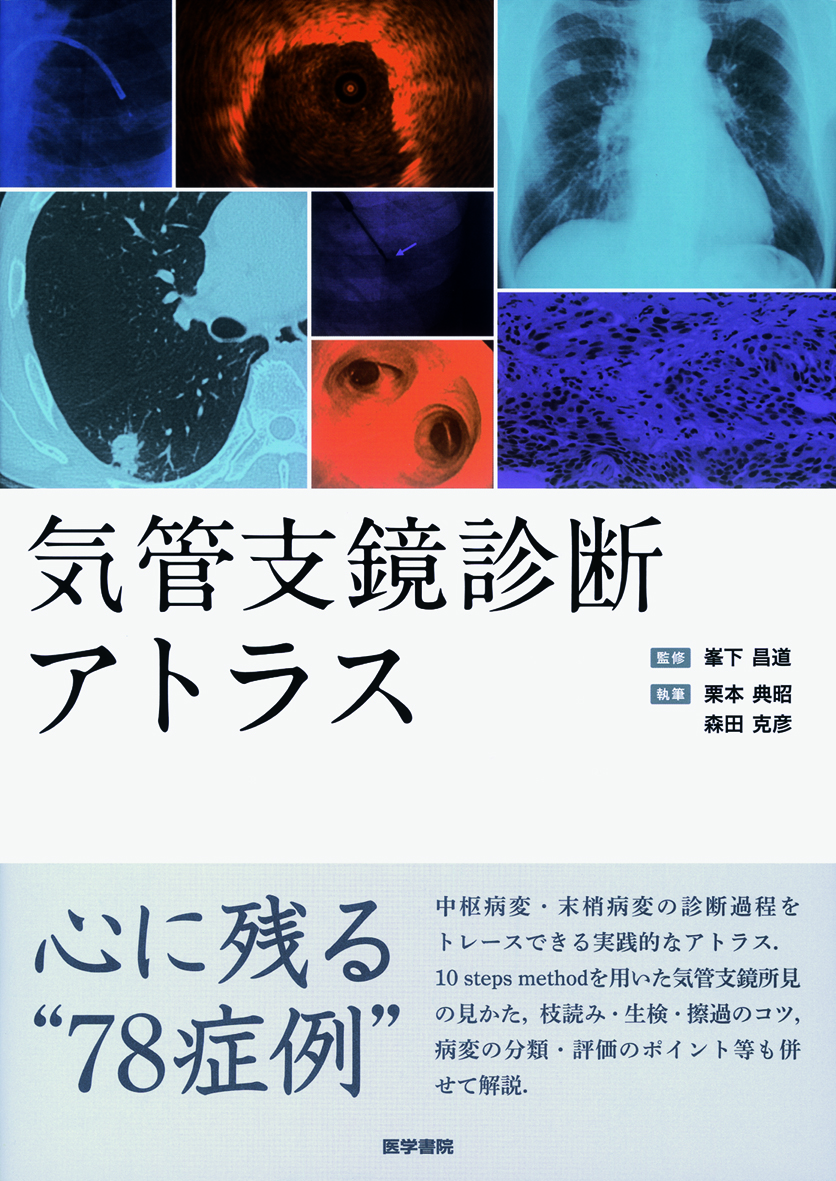 気管支鏡診断アトラス【電子版】 | 医書.jp