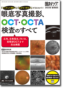 眼底写真撮影、OCT・OCTA検査のすべて | オンラインストア｜看護・医学
