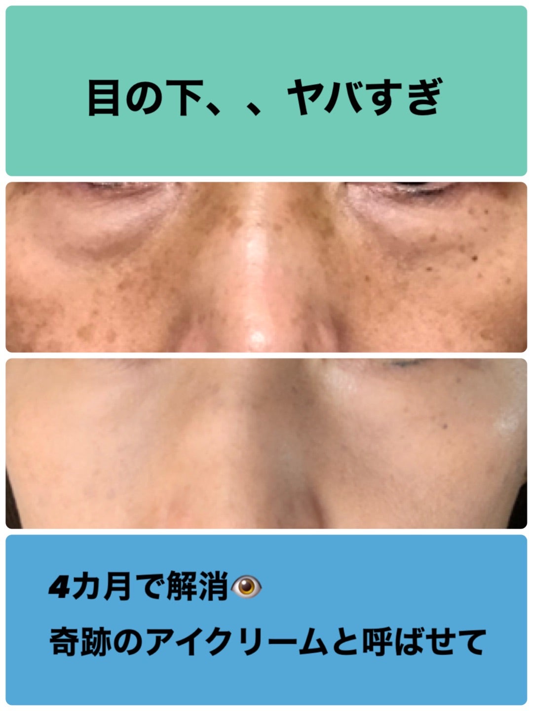 シャルムボー アイクリーム新品♪ 新品】シャルムボー アイクリーム