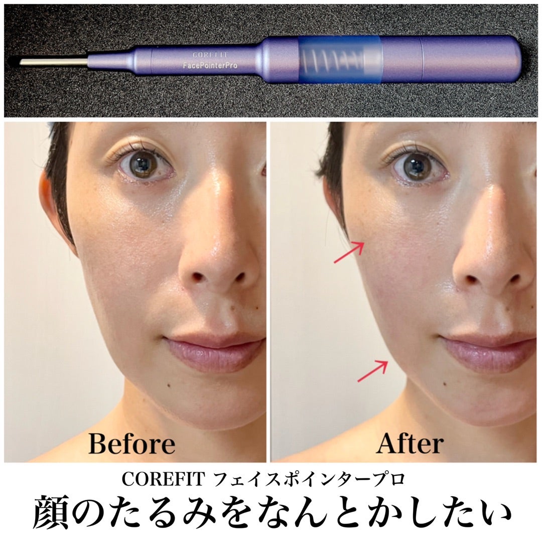 顔のたるみケア＆リフトアップを目指したい！口コミがエグすぎフェイス