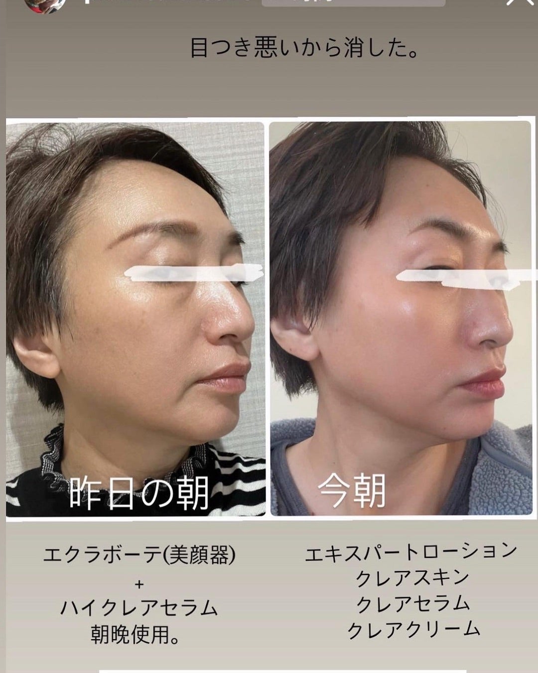 神美顔器 ついに発売！ | 《三島駅南口徒歩5分》沼津・三島で肌改善