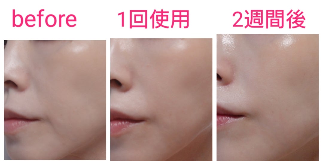 驚愕！！】あの整形級美容液だけを2週間チャレンジ✨とにかく凄いから