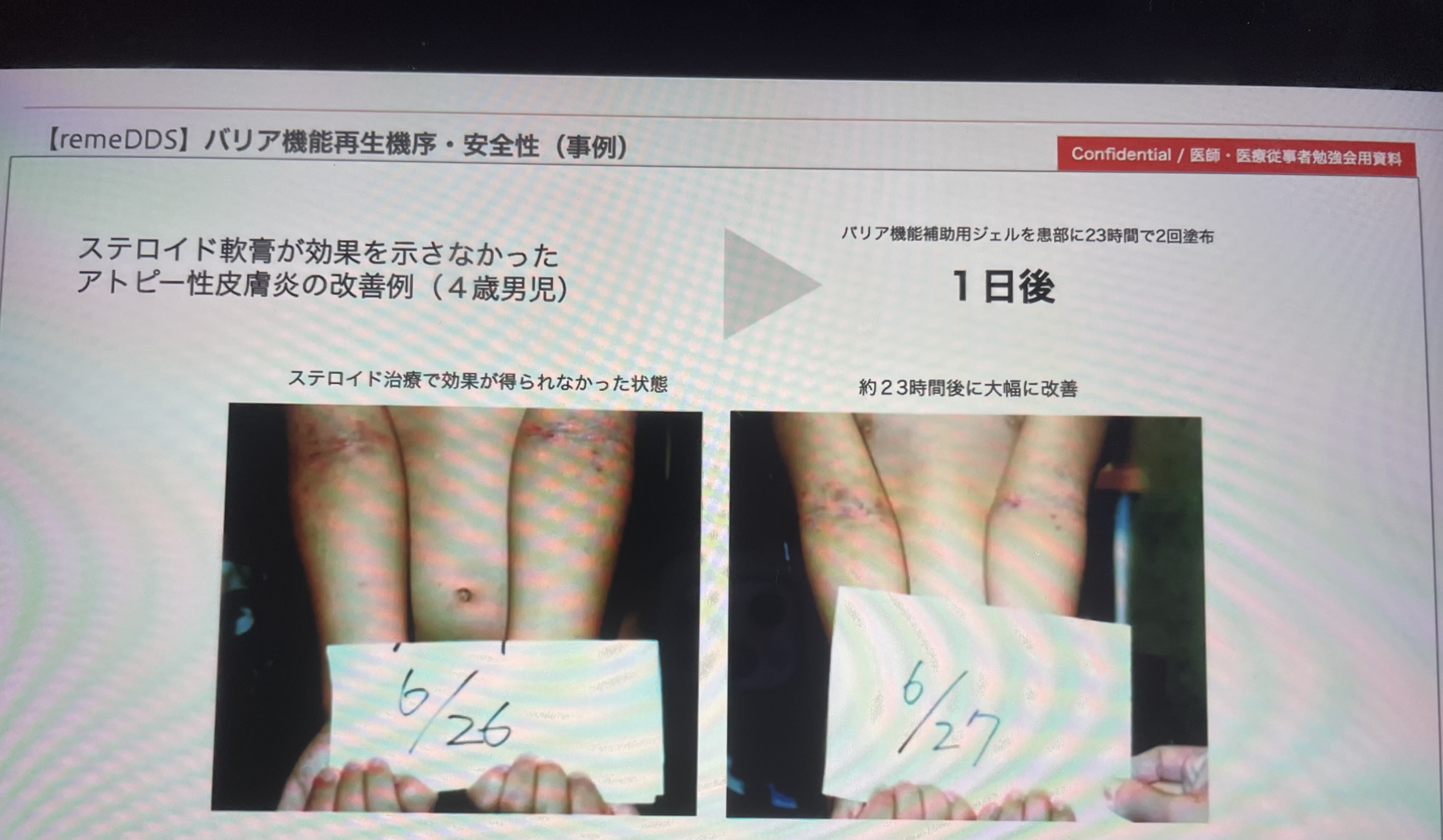 re/me リミーからの待望の新商品！！ | indiva-cocociaのブログ