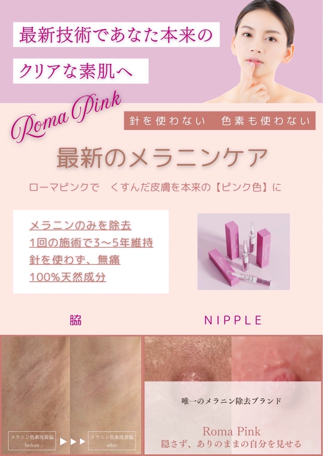 最新メラニンケア】生まれたてのピンク色になるローマピンク 横浜