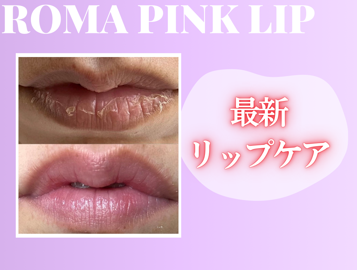 最新】唇・VIO・脇・ニップルの最新くろずみケア「ローマピンク」成城