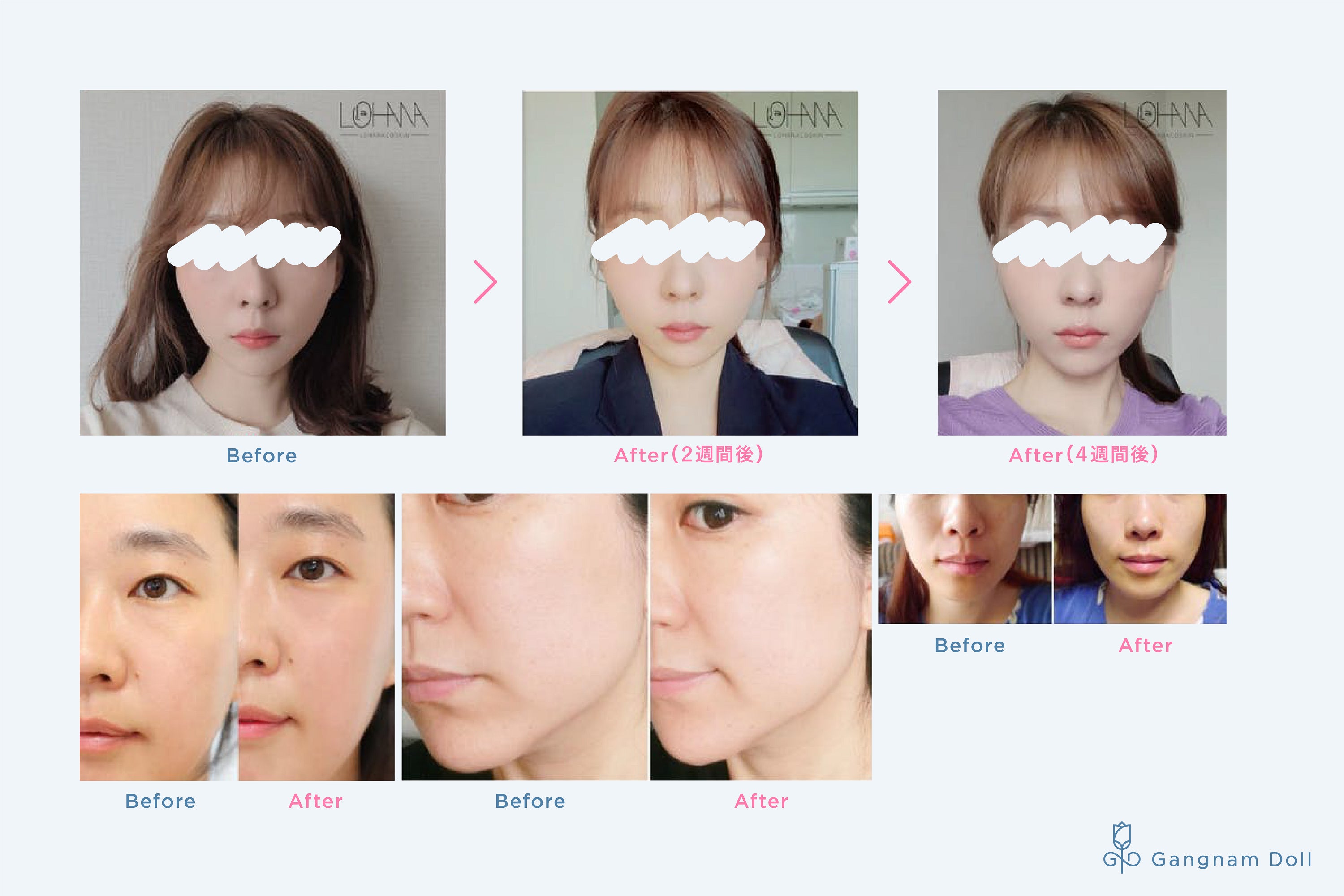 3年ぶりにカンナムドールから新美顔器が発売し、発売初日で目標金額