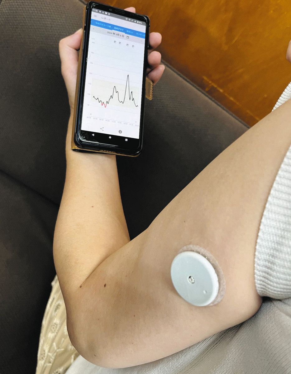 血糖値の変動をスマホで見える化 500円玉大のセンサー装着、糖尿病改善