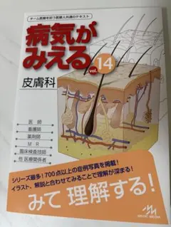 病気がみえる vol.14 - メルカリ